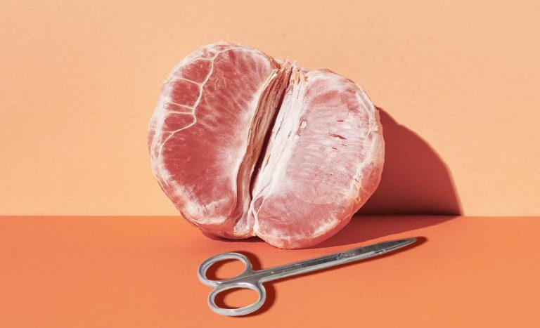 Zafigo x SIS: Changing Perceptions On Female Circumcision In Malaysia
